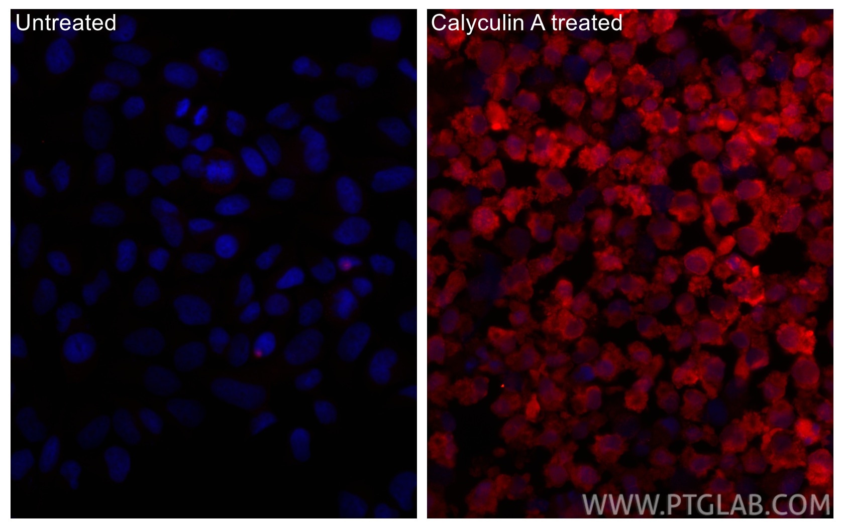 Immunofluorescence (IF) / fluorescent staining of HeLa cells using CoraLite®594-conjugated Phospho-STK11/LKB1 (Thr189 (CL594-80127)