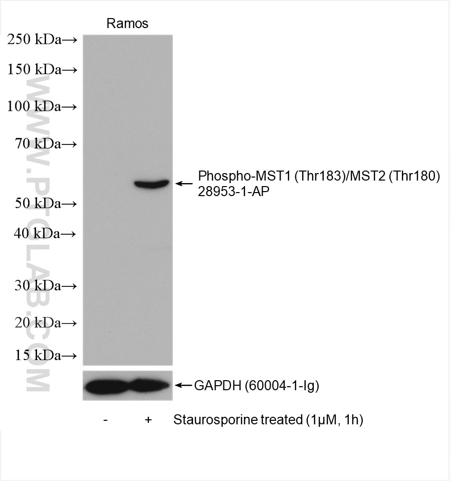 Western Blot (WB) analysis of various lysates using Phospho-MST1 (Thr183)/MST2 (Thr180) Polyclonal ant (28953-1-AP)