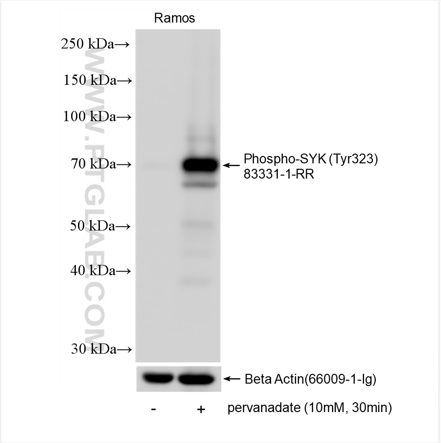 Phospho-SYK (Tyr323)