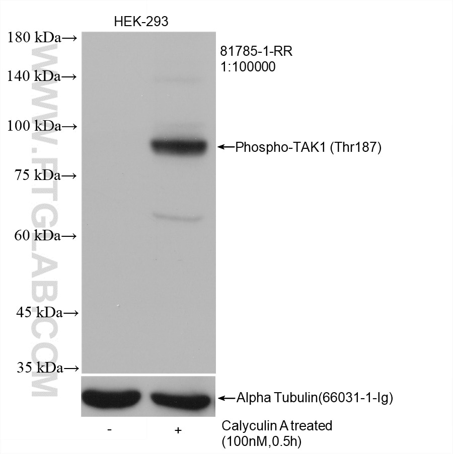 Western Blot (WB) analysis of HEK-293 cells using Phospho-TAK1 (Thr187) Recombinant antibody (81785-1-RR)