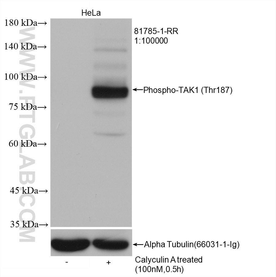 Western Blot (WB) analysis of HeLa cells using Phospho-TAK1 (Thr187) Recombinant antibody (81785-1-RR)