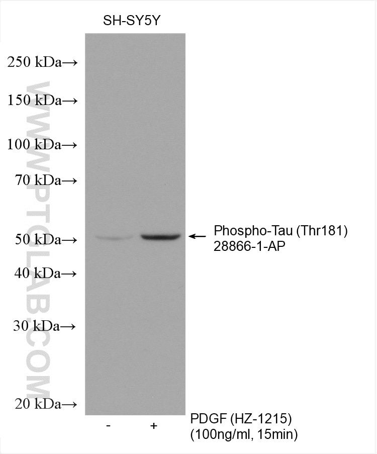Western Blot (WB) analysis of various lysates using Phospho-TAU (Thr181) Polyclonal antibody (28866-1-AP)