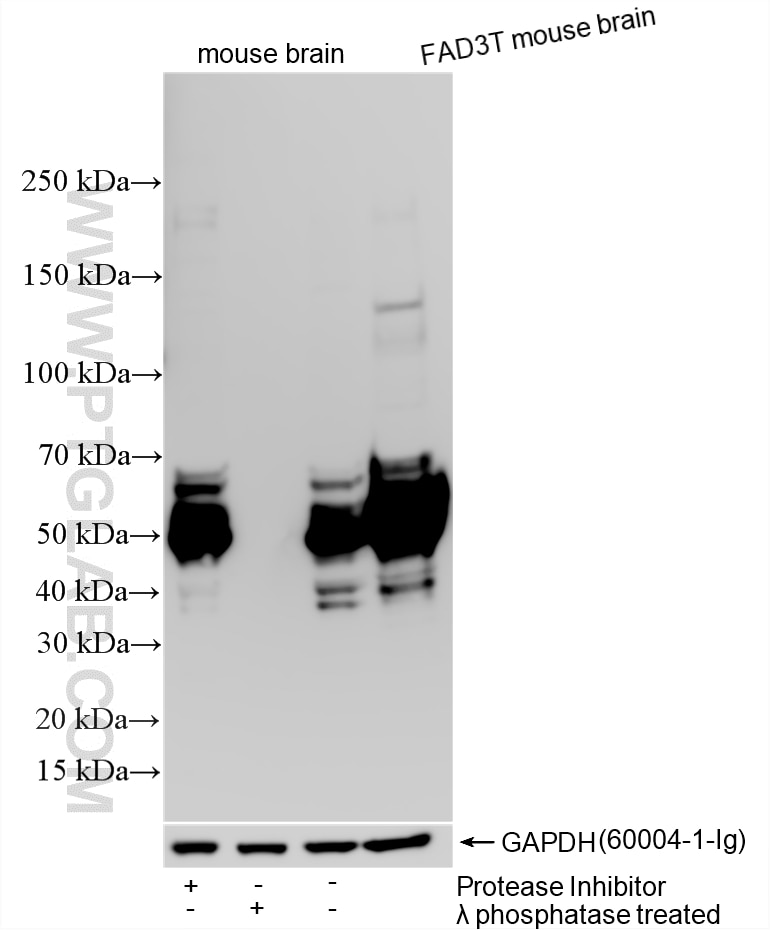 WB analysis using 28866-1-AP Western Blot (WB) analysis of various lysates using Phospho-TAU (Thr181) Polyclonal antibody (28866-1-AP)