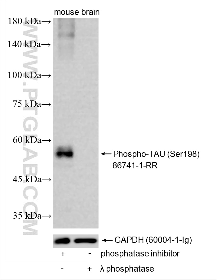 Western Blot (WB) analysis of various lysates using Phospho-TAU (Ser198) Recombinant monoclonal antibo (86741-1-RR)