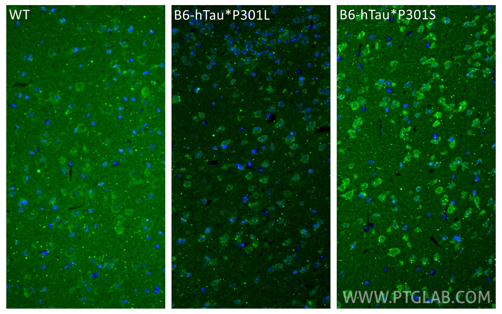 Immunofluorescence (IF) / fluorescent staining of mouse brain tissue using Phospho-TAU (Ser199) Recombinant monoclonal antibo (86995-1-RR)