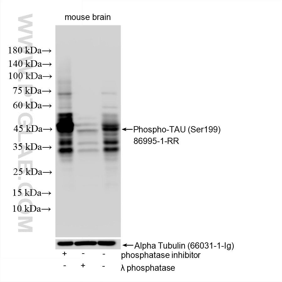 Western Blot (WB) analysis of various lysates using Phospho-TAU (Ser199) Recombinant monoclonal antibo (86995-1-RR)