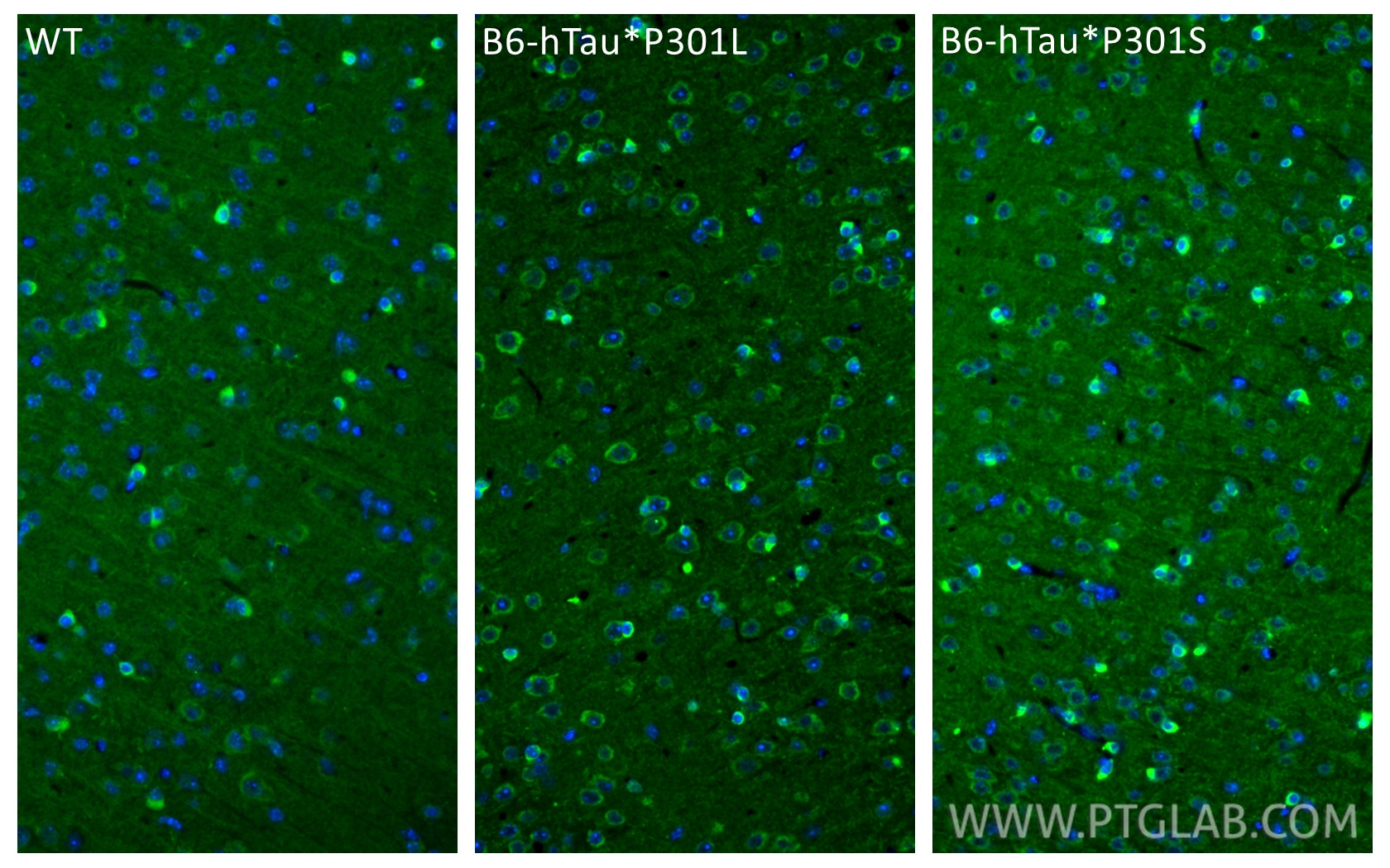 Immunofluorescence (IF) / fluorescent staining of mouse brain tissue using Phospho-TAU (Ser202) Recombinant monoclonal antibo (86748-1-RR)