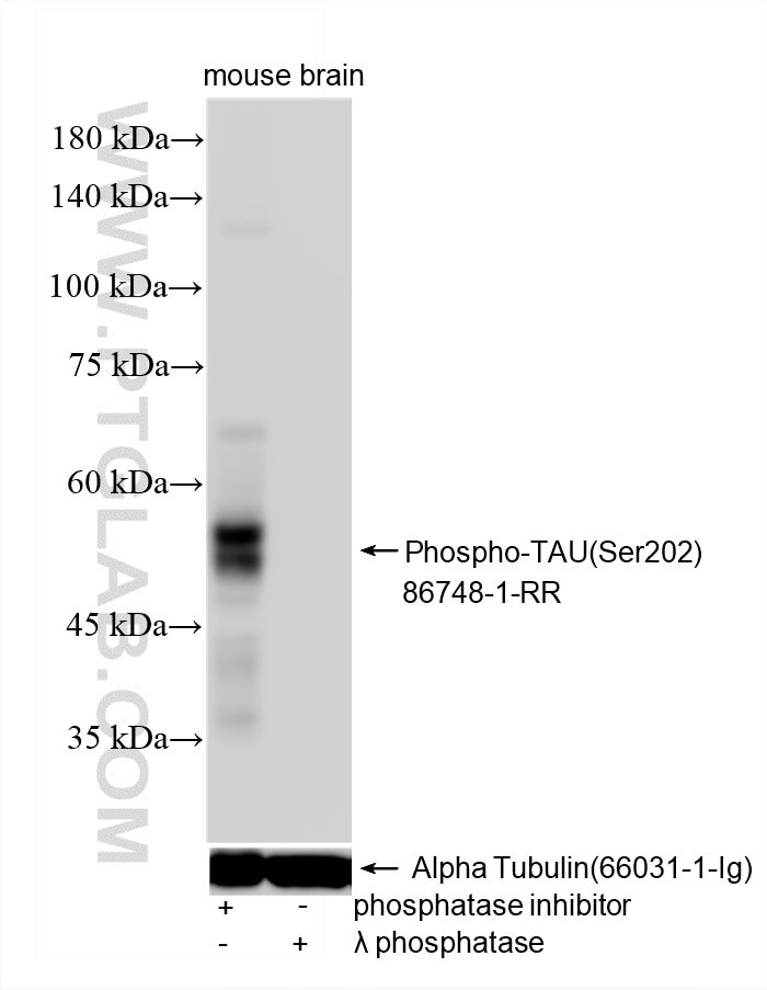 Western Blot (WB) analysis of various lysates using Phospho-TAU (Ser202) Recombinant monoclonal antibo (86748-1-RR)