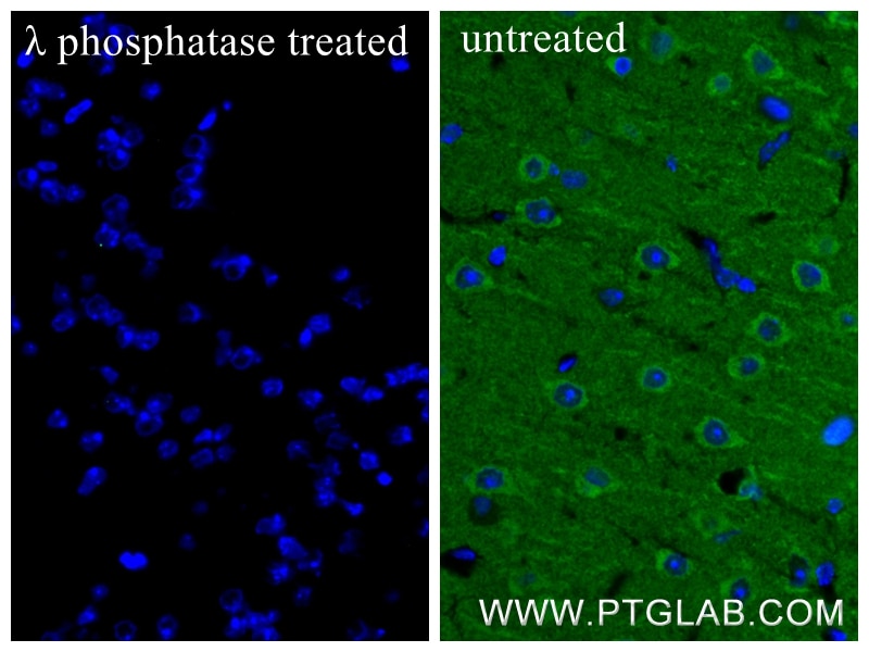 Immunofluorescence (IF) / fluorescent staining of mouse brain tissue using Phospho-TAU (Ser202/Thr205) Recombinant monoclonal (82568-1-RR)
