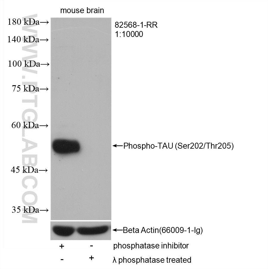 Western Blot (WB) analysis of mouse brain tissue using Phospho-TAU (Ser202/Thr205) Recombinant antibody (82568-1-RR)