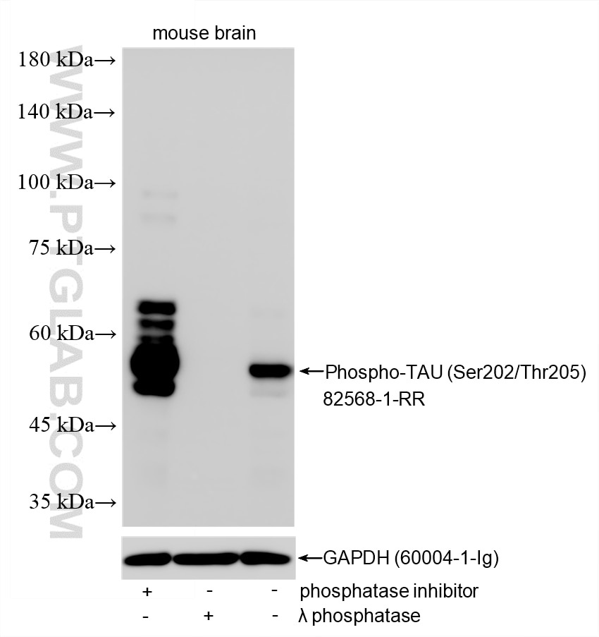 Various lysates were subjected to SDS PAGE followed by western blot with 82568-1-RR (Phospho-TAU (Ser202/Thr205) antibody) at dilution of 1:20000 incubated at room temperature for 1.5 hours. Western Blot (WB) analysis of various lysates using Phospho-TAU (Ser202/Thr205) Recombinant monoclonal (82568-1-RR)
