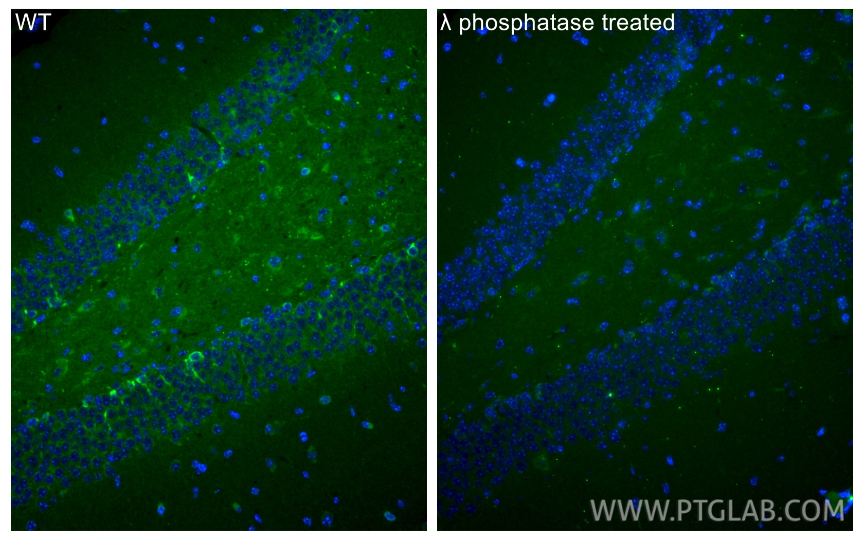 IF Staining of mouse brain using CL488-82568 Immunofluorescence (IF) / fluorescent staining of mouse brain tissue using CoraLite® Plus 488-conjugated Phospho-TAU (Ser202/ (CL488-82568)