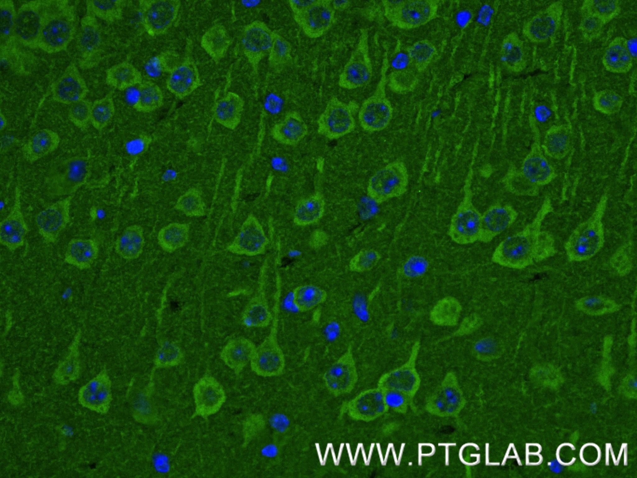 Immunofluorescence (IF) / fluorescent staining of mouse brain tissue using Phospho-TAU (Ser214) Recombinant monoclonal antibo (87043-3-RR)