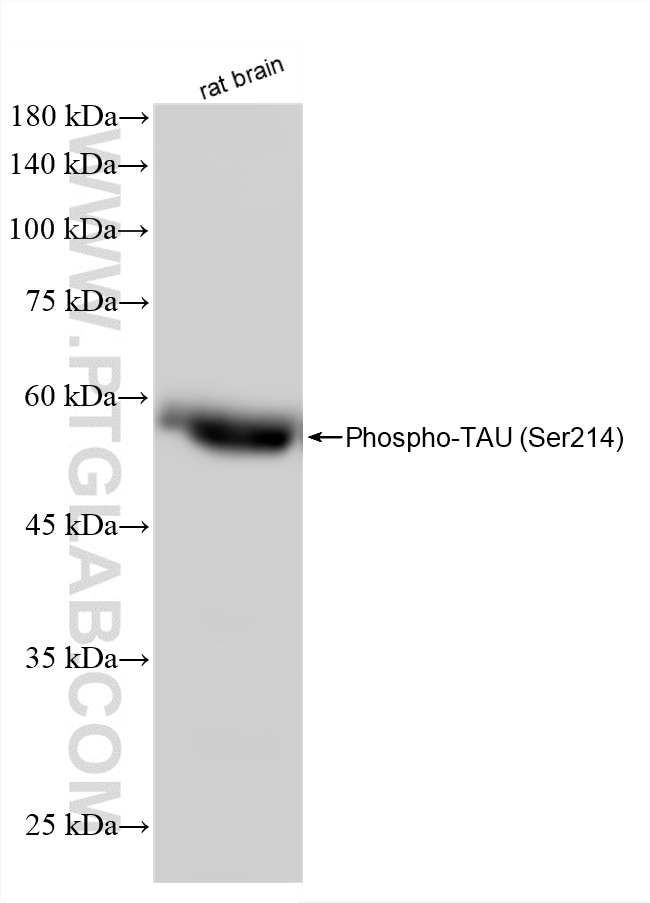 Western Blot (WB) analysis of rat brain tissue using Phospho-TAU (Ser214) Recombinant monoclonal antibo (87043-3-RR)
