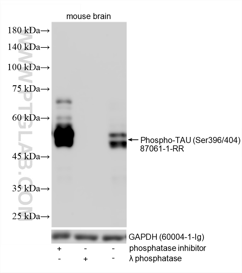 Western Blot (WB) analysis of various lysates using Phospho-TAU (Ser396/404) Recombinant monoclonal an (87061-1-RR)