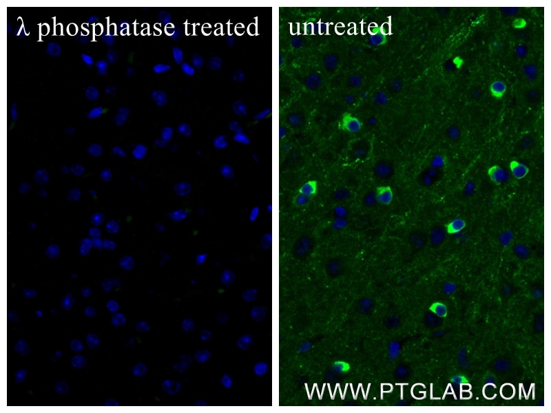 Immunofluorescence (IF) / fluorescent staining of mouse brain tissue using Phospho-TAU (Ser396) Recombinant monoclonal antibo (87029-11-RR)