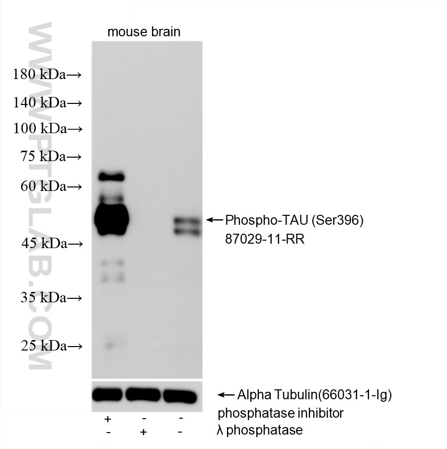 Western Blot (WB) analysis of various lysates using Phospho-TAU (Ser396) Recombinant monoclonal antibo (87029-11-RR)