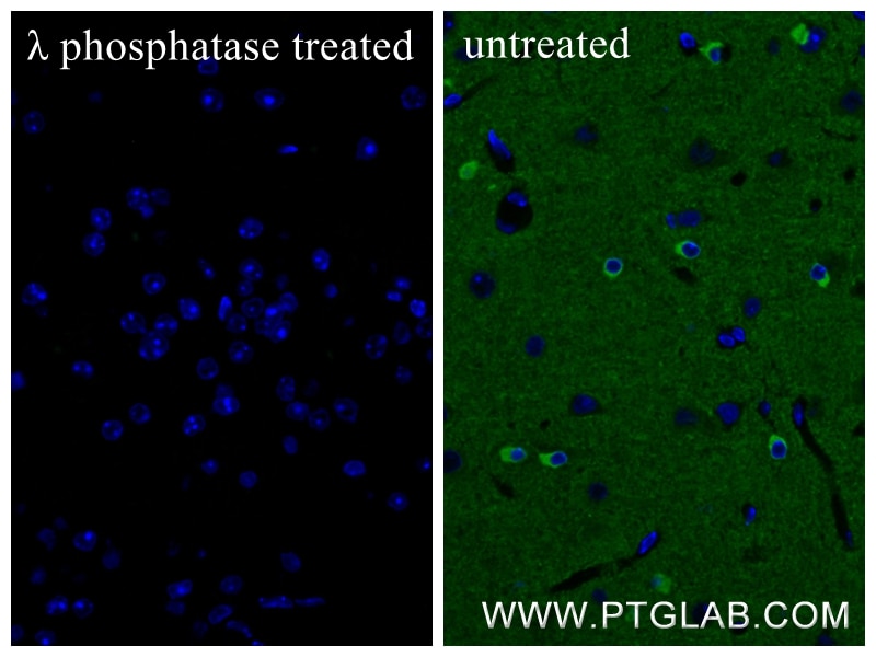 Immunofluorescence (IF) / fluorescent staining of mouse brain tissue using Phospho-TAU (Ser404) Recombinant monoclonal antibo (81383-1-RR)