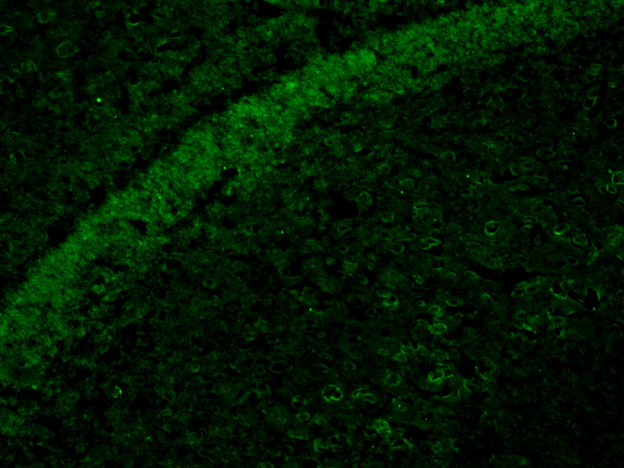 Immunofluorescence (IF) / fluorescent staining of mouse brain tissue using Phospho-TAU (Ser404) Recombinant monoclonal antibo (81383-1-RR)