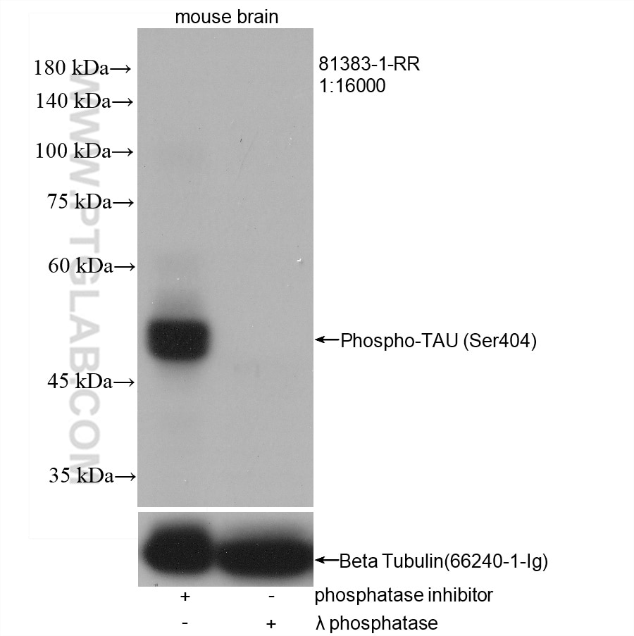 Western Blot (WB) analysis of mouse brain tissue using Phospho-TAU (Ser404) Recombinant antibody (81383-1-RR)