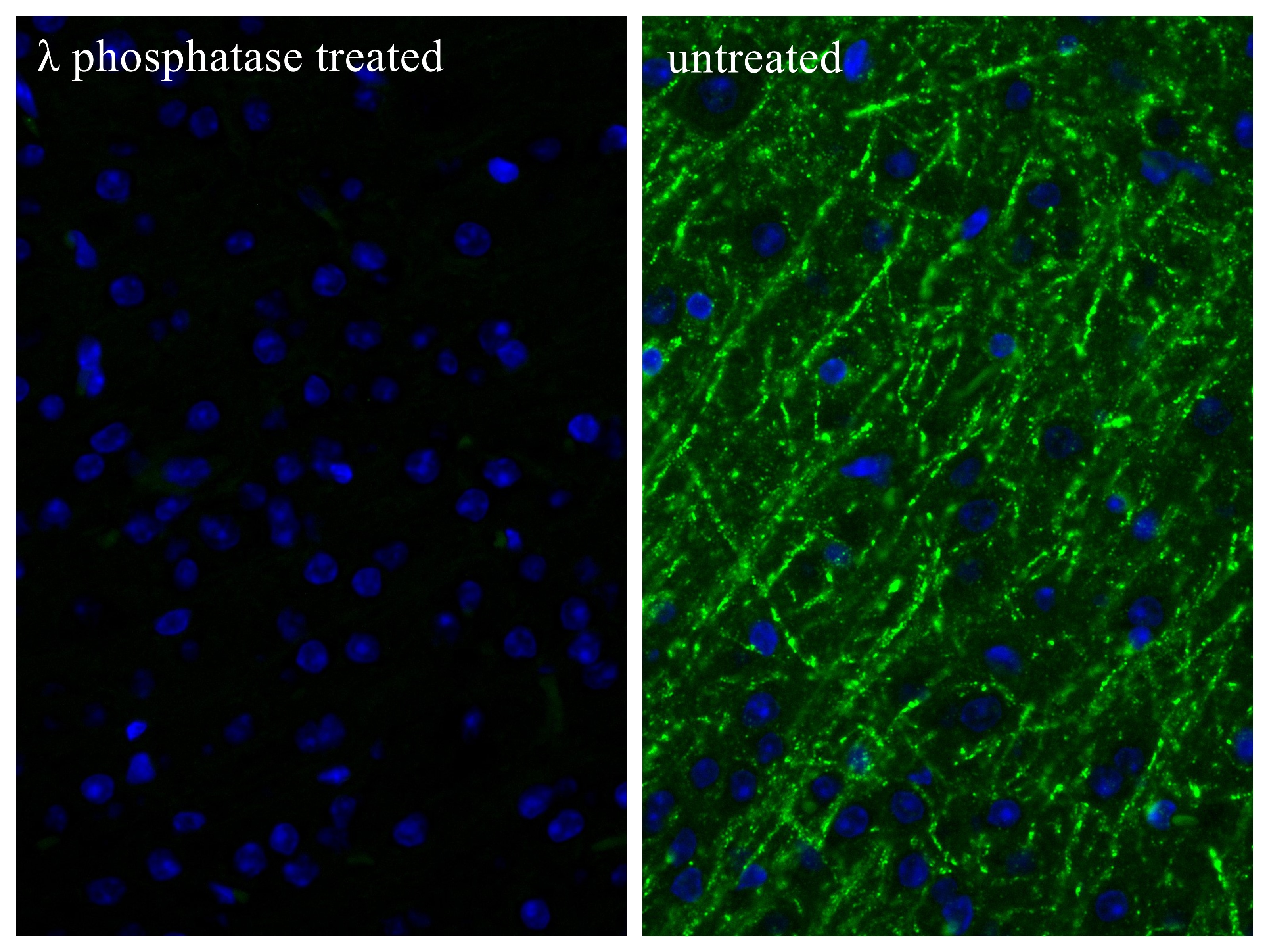 Immunofluorescence (IF) / fluorescent staining of mouse brain tissue using Phospho-TAU (Ser409) Recombinant monoclonal antibo (87019-1-RR)