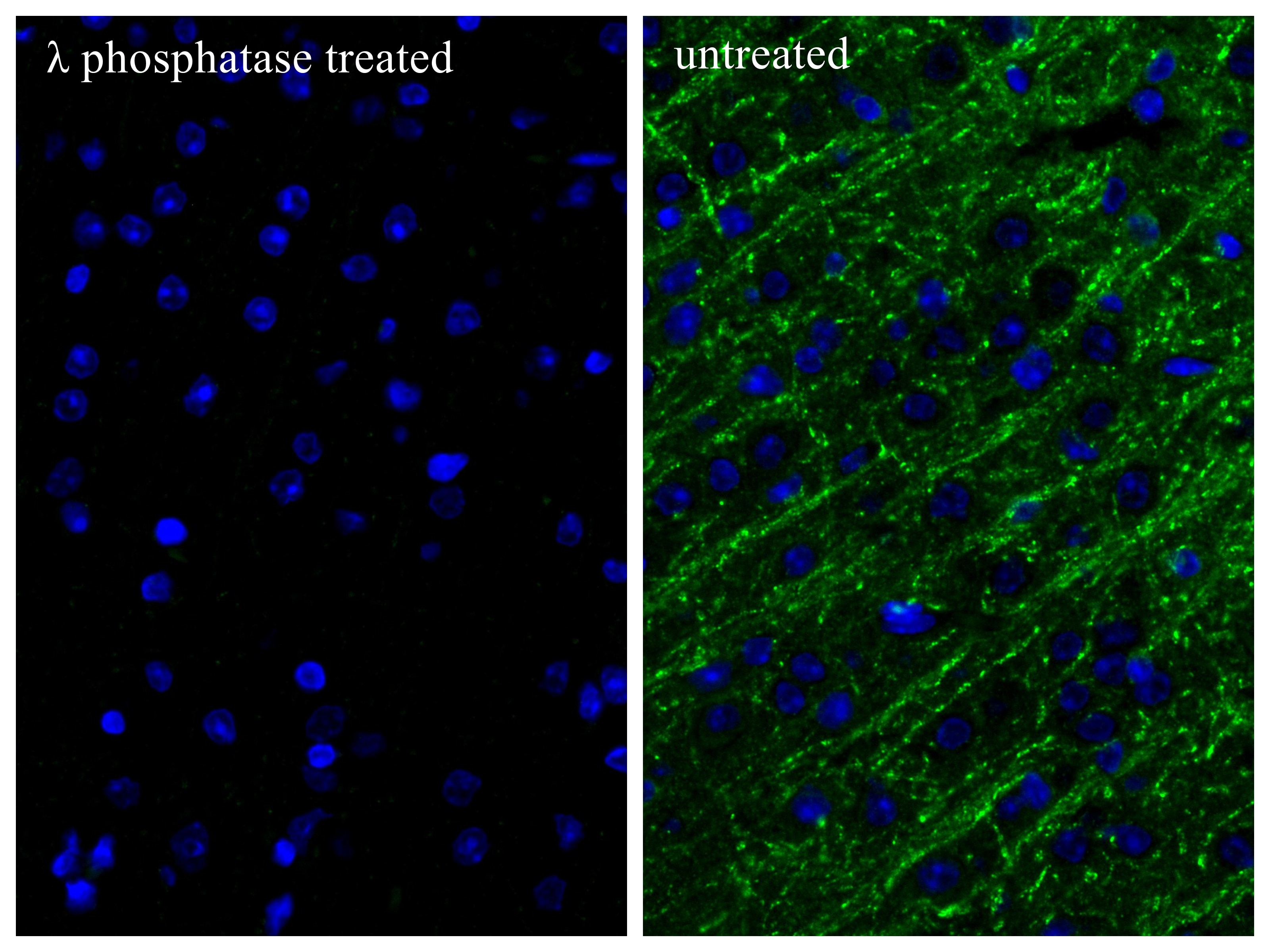 Immunofluorescence (IF) / fluorescent staining of mouse brain tissue using Phospho-TAU (Ser413) Recombinant monoclonal antibo (87025-7-RR)