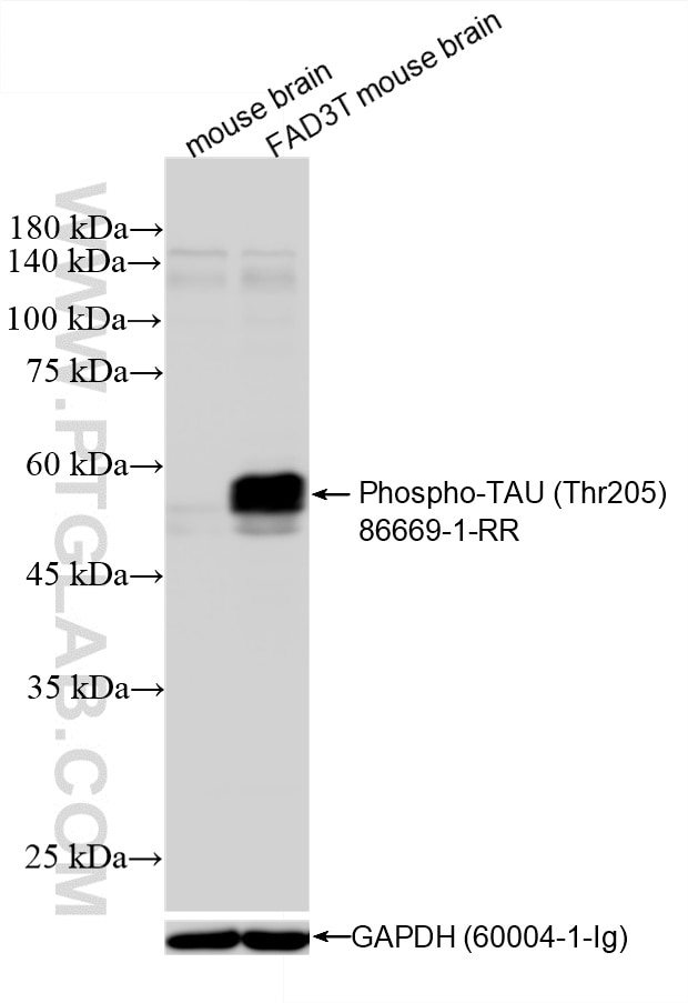 Western Blot (WB) analysis of various lysates using Phospho-TAU (Thr205) Recombinant monoclonal antibo (86669-1-RR)