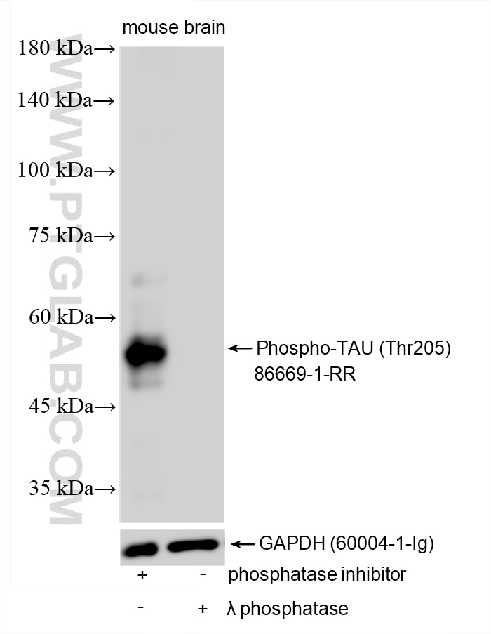 Western Blot (WB) analysis of various lysates using Phospho-TAU (Thr205) Recombinant monoclonal antibo (86669-1-RR)