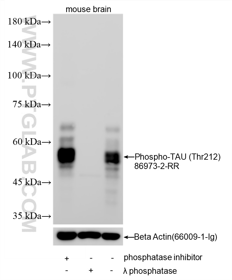 Western Blot (WB) analysis of various lysates using Phospho-TAU (Thr212) Recombinant monoclonal antibo (86973-2-RR)