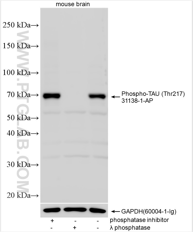 Non-treated mouse brain tissue, phosphatase inhibitor treated mouse brain tissue and λ phosphatase treated mouse brain tissue were subjected to SDS PAGE followed by western blot with 31138-1-AP (Phospho-TAU (Thr217) antibody) at dilution of 1:500 incubated at room temperature for 1.5 hours. The membrane was stripped and re-blotted with GAPDH (60004-1-Ig) antibody as a loading control. Western Blot (WB) analysis of various lysates using Phospho-TAU (Thr217) Polyclonal antibody (31138-1-AP)
