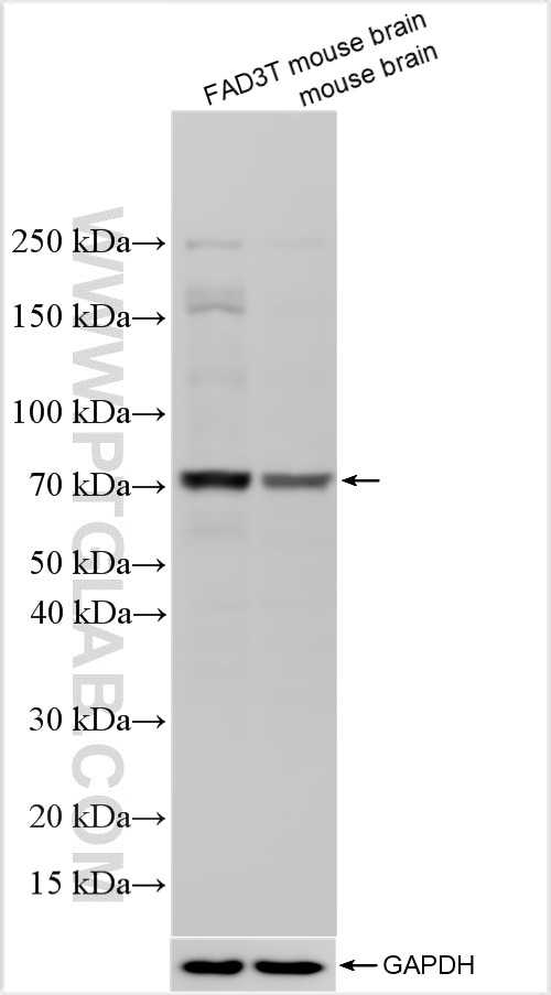 Various lysates were subjected to SDS PAGE followed by western blot with 31138-1-AP (Phospho-TAU (Thr217) antibody) at dilution of 1:600 incubated at room temperature for 1.5 hours. The membrane was stripped and re-blotted with GAPDH antibody as loading control. The FAD3T mouse is a triple transgenic model expressing APP, PS1, and Tau transgenes. Western Blot (WB) analysis of various lysates using Phospho-TAU (Thr217) Polyclonal antibody (31138-1-AP)