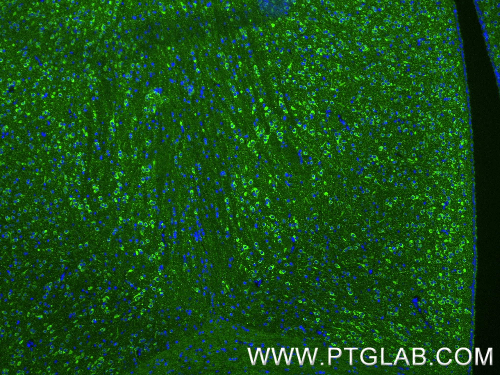 Immunofluorescent analysis of (4% PFA) fixed paraffin-embedded mouse brain tissue using Phospho-TAU (Thr231) antibody (80101-7-RR, Clone: 240632B1 ) at dilution of 1:0 and CoraLite®488-Conjugated Goat Anti-Rabbit IgG(H+L) (SA00013-2). Heat mediated antigen retrieval with Tris-EDTA buffer (pH 9.0). This data was developed using the same antibody clone with 80101-7-PBS in a different storage buffer formulation. Immunofluorescence (IF) / fluorescent staining of mouse brain tissue using Phospho-TAU (Thr231) Recombinant monoclonal antibo (80101-7-RR)