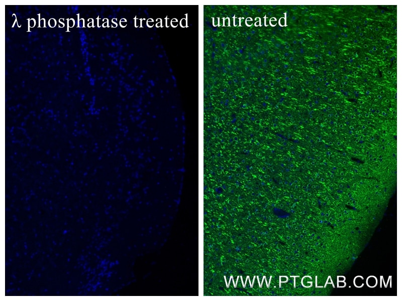 Immunofluorescent analysis of (4% PFA) fixed paraffin-embedded λ phosphatase treated mouse brain tissue using Phospho-TAU (Thr231) antibody (80101-7-RR, Clone: 240632B1 ) at dilution of 1:500 and CoraLite®488-Conjugated Goat Anti-Rabbit IgG(H+L) (SA00013-2). Heat mediated antigen retrieval with Tris-EDTA buffer (pH 9.0). This data was developed using the same antibody clone with 80101-7-PBS in a different storage buffer formulation. Immunofluorescence (IF) / fluorescent staining of mouse brain tissue using Phospho-TAU (Thr231) Recombinant monoclonal antibo (80101-7-RR)