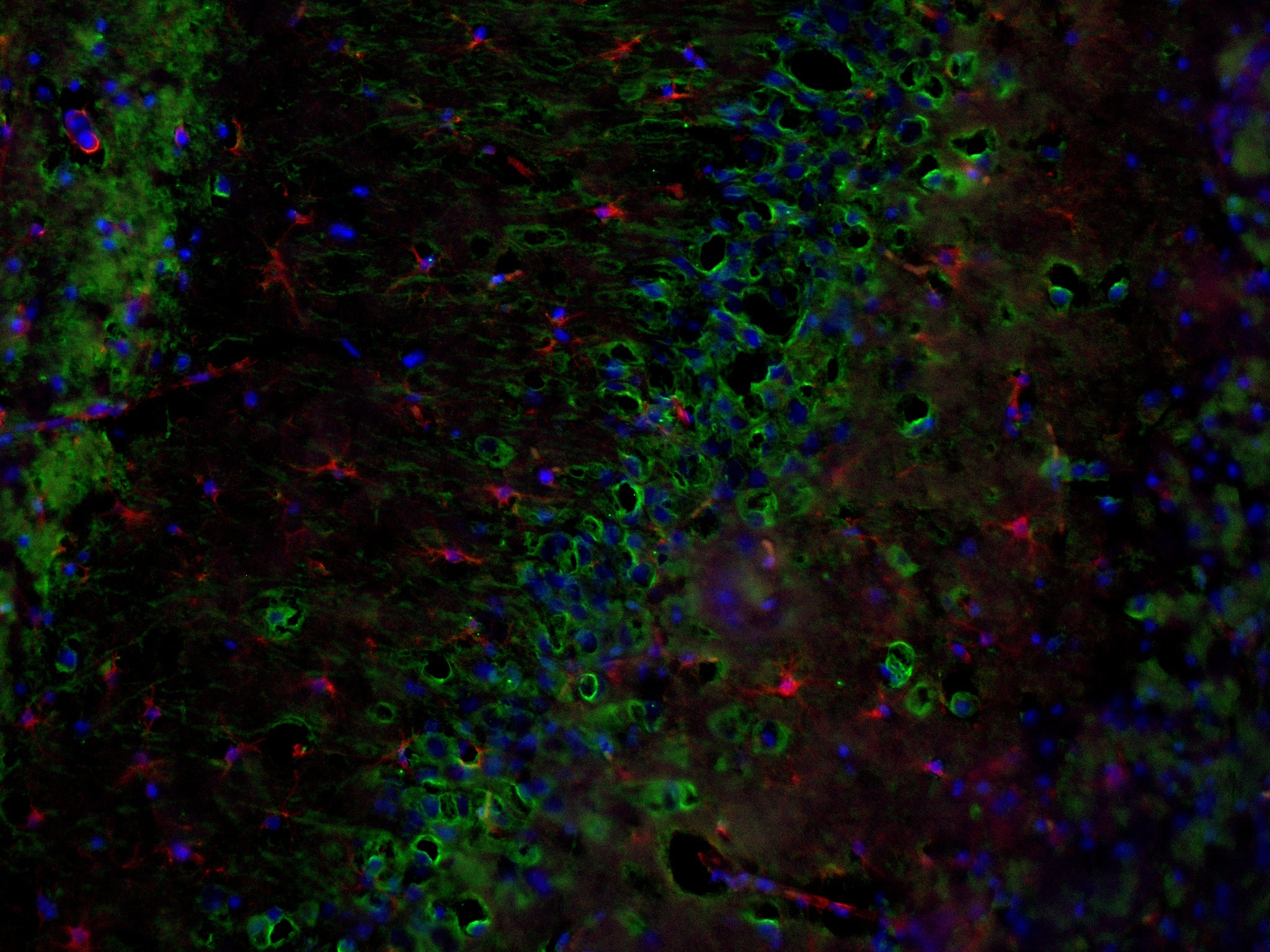 IF Staining of mouse brain using 80101-7-RR (same clone as 80101-7-PBS) Immunofluorescence (IF) / fluorescent staining of mouse brain tissue using Phospho-TAU (Thr231) Recombinant monoclonal antibo (80101-7-RR)