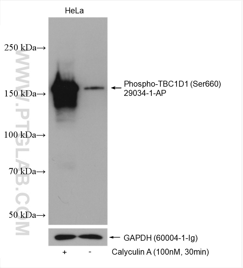 Western Blot (WB) analysis of various lysates using Phospho-TBC1D1 (Ser660) Polyclonal antibody (29034-1-AP)