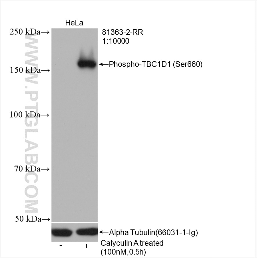 Western Blot (WB) analysis of HeLa cells using Phospho-TBC1D1 (Ser660) Recombinant antibody (81363-2-RR)