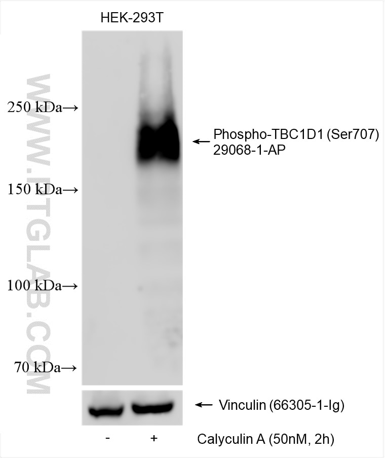 Western Blot (WB) analysis of various lysates using Phospho-TBC1D1 (Ser707) Polyclonal antibody (29068-1-AP)
