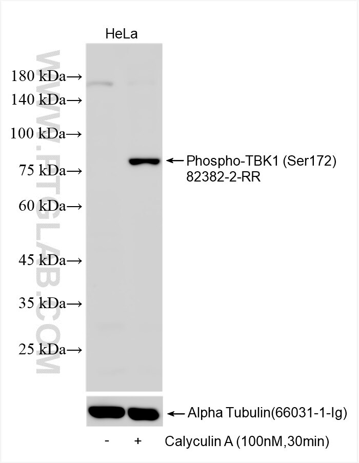 Western Blot (WB) analysis of various lysates using Phospho-TBK1 (Ser172) Recombinant antibody (82382-2-RR)