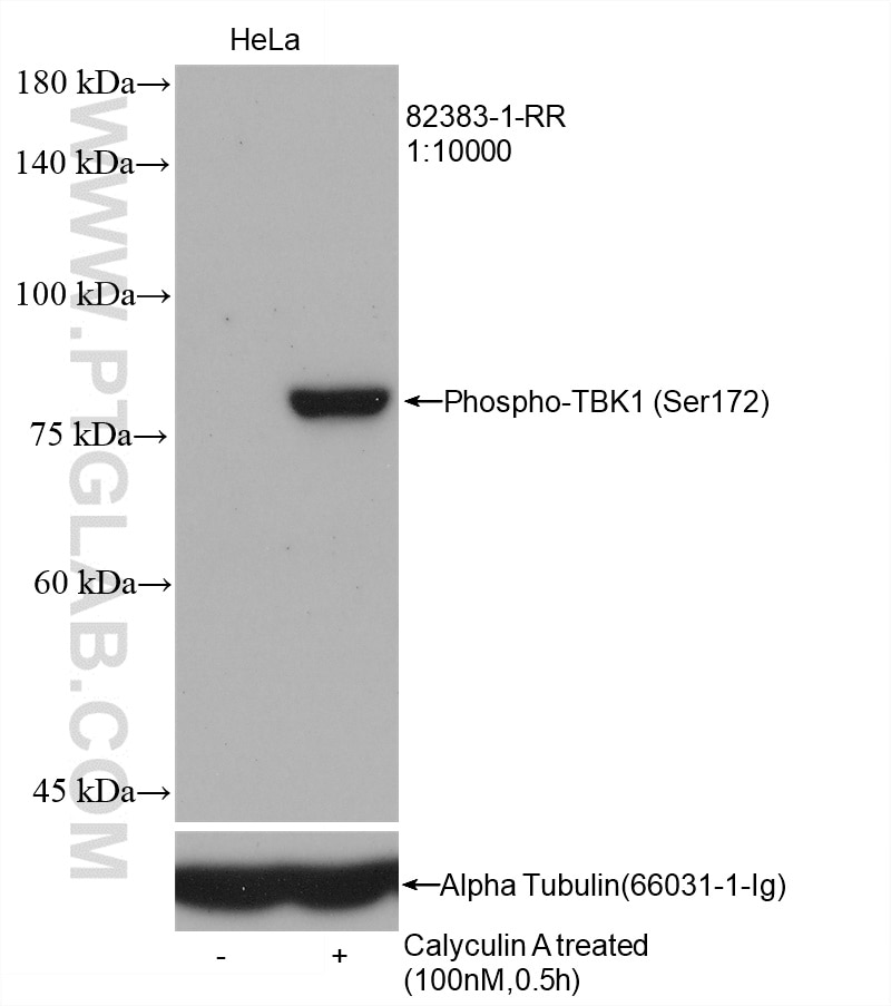 Western Blot (WB) analysis of HeLa cells using Phospho-TBK1 (Ser172) Recombinant antibody (82383-1-RR)
