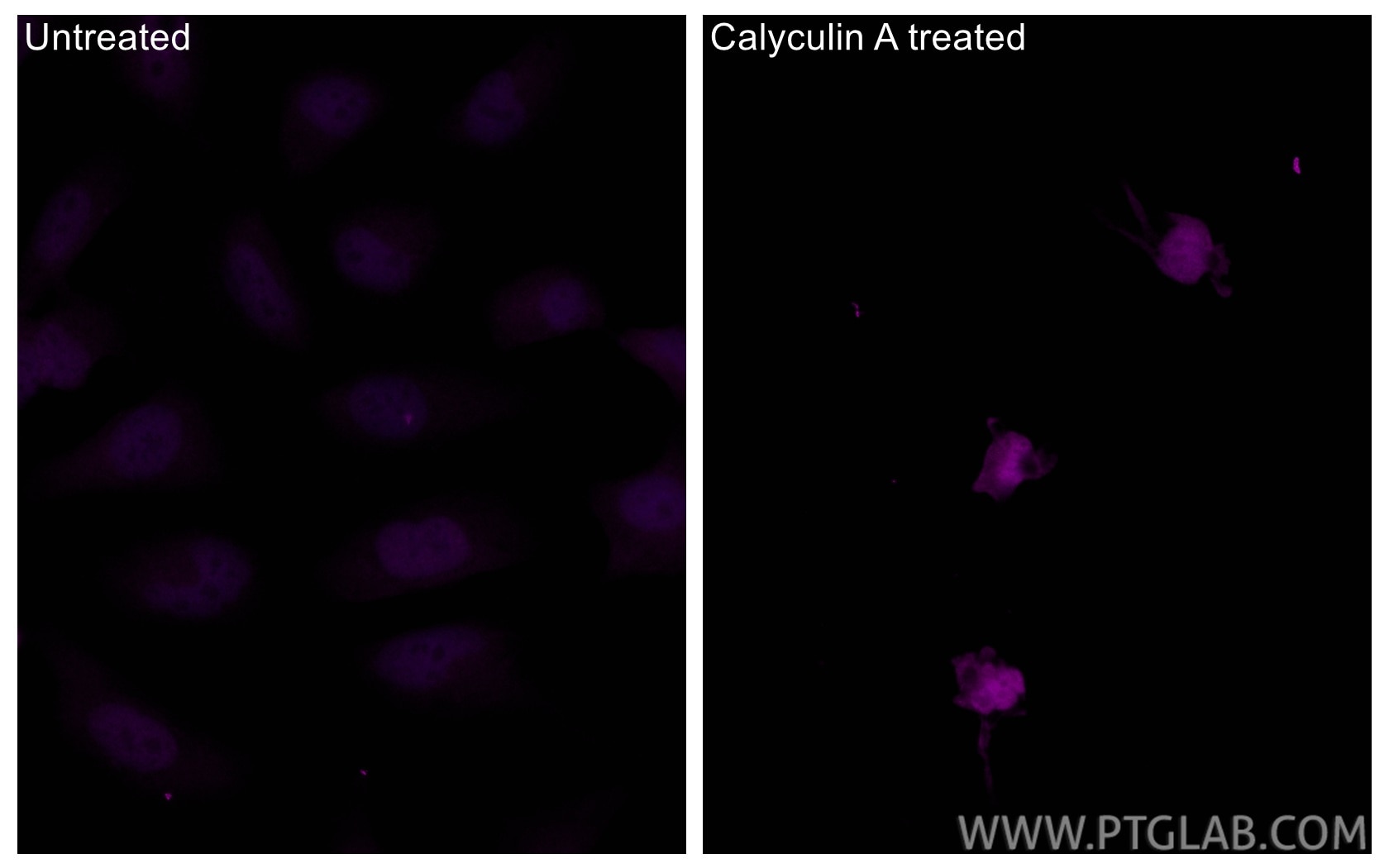 Immunofluorescence (IF) / fluorescent staining of HeLa cells using CoraLite® Plus 647-conjugated Phospho-TDP43 (Ser40 (CL647-80007)