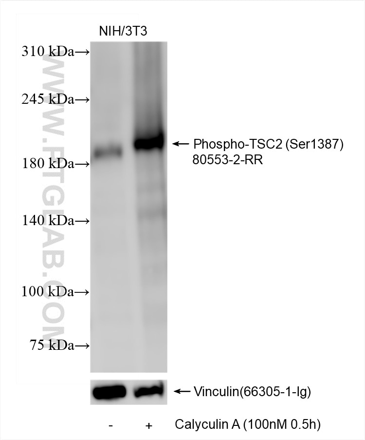 Non-treated and Calyculin A treated NIH/3T3 cells were subjected to SDS PAGE followed by western blot with 80553-2-RR (Phospho-TSC2 (Ser1387) antibody) at dilution of 1:2000 incubated at room temperature for 1.5 hours. The membrane was stripped and re-blotted with Vinculin antibody (66305-1-Ig) as the loading control. Western Blot (WB) analysis of various lysates using Phospho-TSC2 (Ser1387) Recombinant antibody (80553-2-RR)
