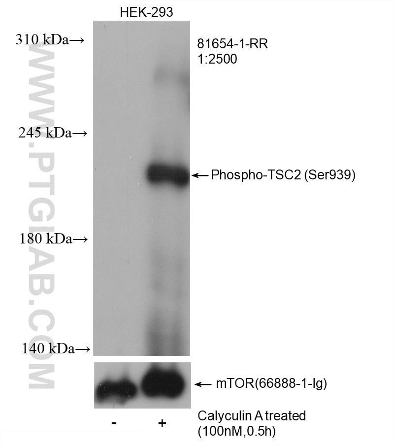 Western Blot (WB) analysis of HEK-293 cells using Phospho-TSC2 (Ser939) Recombinant antibody (81654-1-RR)