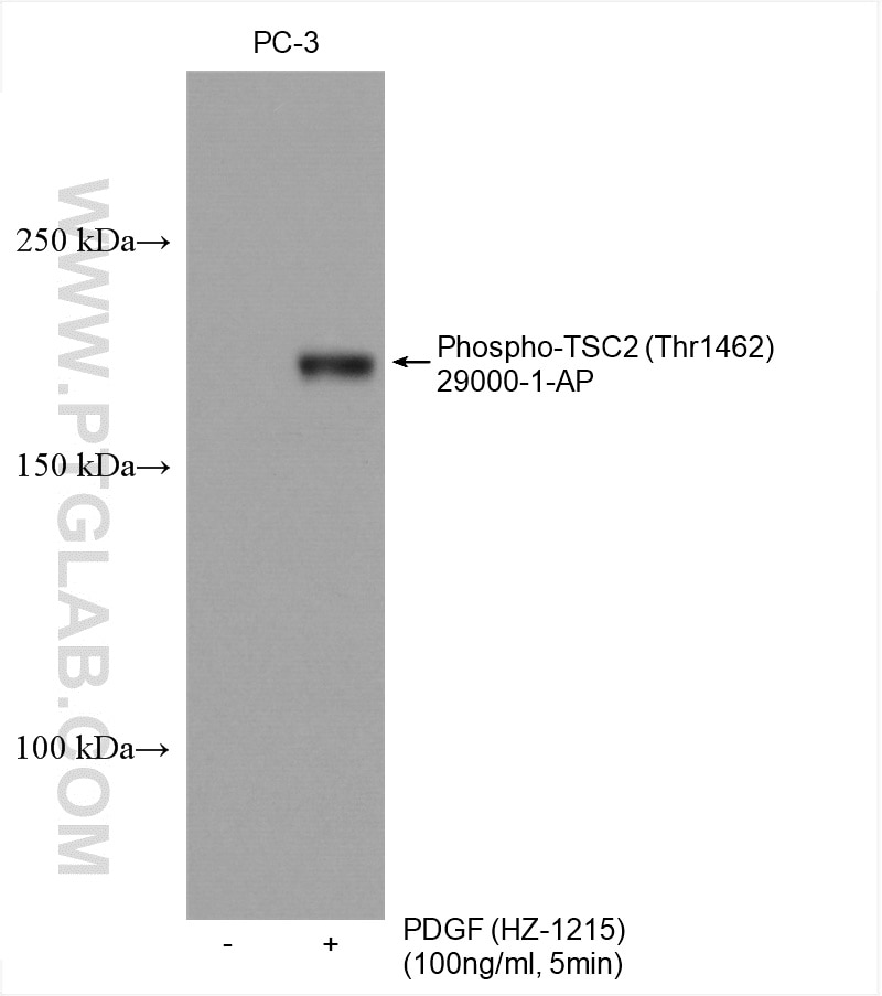 Western Blot (WB) analysis of various lysates using Phospho-TSC2 (Thr1462) Polyclonal antibody (29000-1-AP)