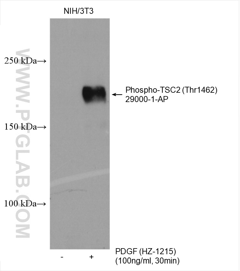 Western Blot (WB) analysis of various lysates using Phospho-TSC2 (Thr1462) Polyclonal antibody (29000-1-AP)