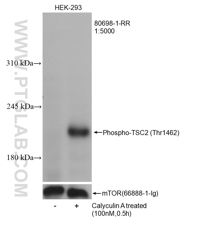 Western Blot (WB) analysis of HEK-293 cells using Phospho-TSC2 (Thr1462) Recombinant antibody (80698-1-RR)
