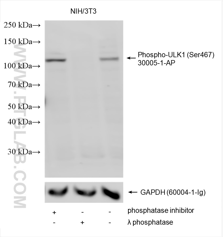 Western Blot (WB) analysis of various lysates using Phospho-ULK1 (Ser467) Polyclonal antibody (30005-1-AP)