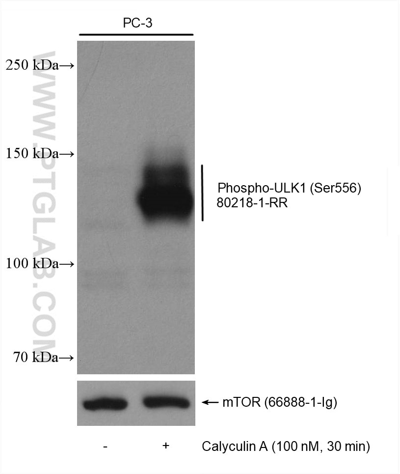 Western Blot (WB) analysis of various lysates using Phospho-ULK1 (Ser556) Recombinant antibody (80218-1-RR)