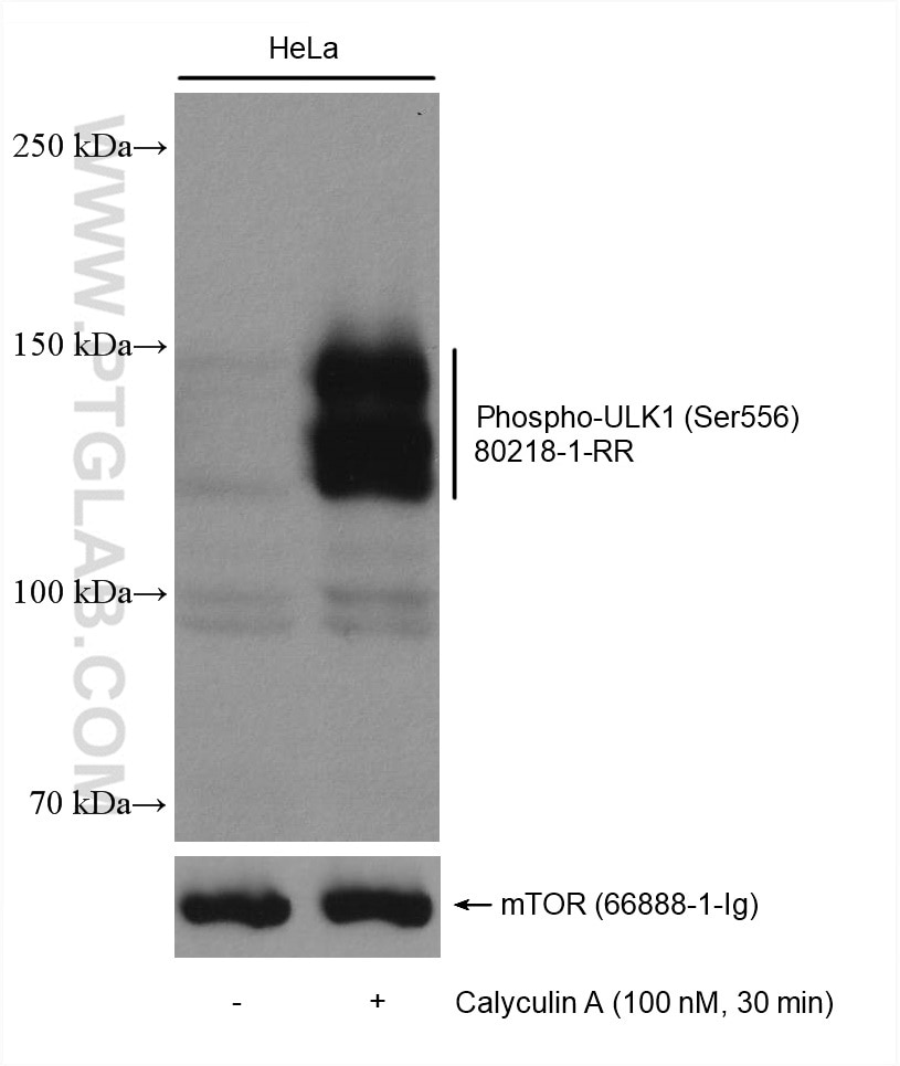 Western Blot (WB) analysis of various lysates using Phospho-ULK1 (Ser556) Recombinant antibody (80218-1-RR)