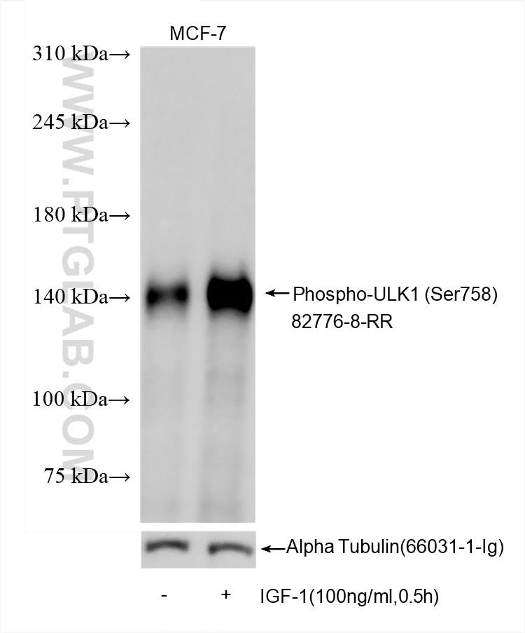 Non-treated and IGF-1 treated MCF-7 cells were subjected to SDS PAGE followed by western blot with 82776-8-RR (Phospho-ULK1 (Ser758) antibody) at dilution of 1:5000 incubated at room temperature for 1.5 hours. The membrane was tripped and re-blotted with Alpha Tubulin antibody (66031-1-Ig) as loading control. Western Blot (WB) analysis of various lysates using Phospho-ULK1 (Ser758) Recombinant antibody (82776-8-RR)