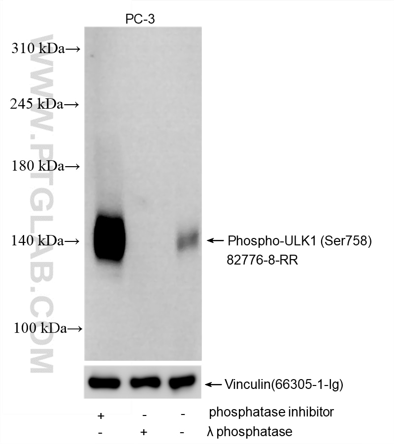 Western Blot (WB) analysis of various lysates using Phospho-ULK1 (Ser758) Recombinant monoclonal antib (82776-8-RR)